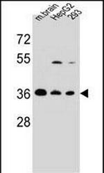 FBXO2 Antibody in Western Blot (WB)