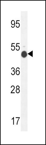 GCNT2 Antibody in Western Blot (WB)