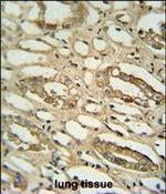 GGTLC2 Antibody in Immunohistochemistry (Paraffin) (IHC (P))