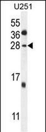 GGTLC2 Antibody in Western Blot (WB)