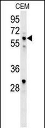 IKAROS Antibody in Western Blot (WB)