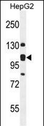 KIAA0090 Antibody in Western Blot (WB)