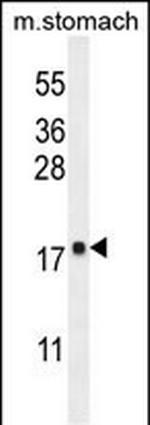 DYNLRB2 Antibody in Western Blot (WB)