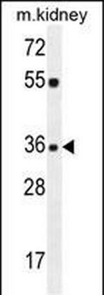 KLF14 Antibody in Western Blot (WB)