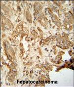 NAT14 Antibody in Immunohistochemistry (Paraffin) (IHC (P))