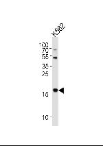 NAT14 Antibody in Western Blot (WB)