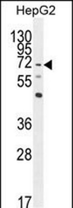 LRRC33 Antibody in Western Blot (WB)