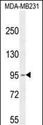 KCNT2 Antibody in Western Blot (WB)