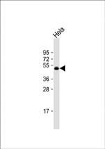 CEPT1 Antibody in Western Blot (WB)