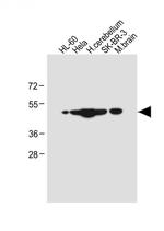 CEPT1 Antibody in Western Blot (WB)