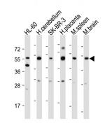 CEPT1 Antibody in Western Blot (WB)