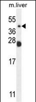 NEU4 Antibody in Western Blot (WB)