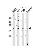 IBA1 Antibody in Western Blot (WB)