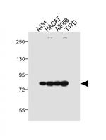 ALOXE3 Antibody in Western Blot (WB)