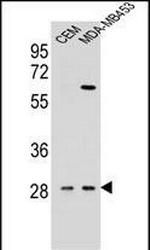 IL-12 p40 Antibody in Western Blot (WB)