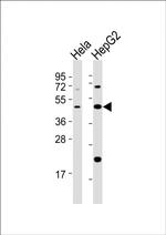 E2F2 Antibody in Western Blot (WB)