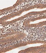 Collagen V Antibody in Immunohistochemistry (Paraffin) (IHC (P))