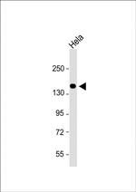 Collagen V Antibody in Western Blot (WB)