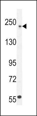 Collagen V Antibody in Western Blot (WB)