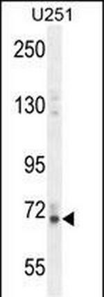 Vitrin Antibody in Western Blot (WB)