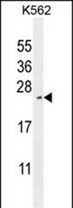 RTP4 Antibody in Western Blot (WB)