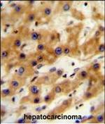 GAGE13 Antibody in Immunohistochemistry (Paraffin) (IHC (P))