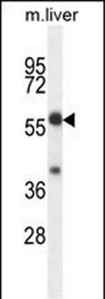 TBCCD1 Antibody in Western Blot (WB)