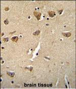 CPLX3 Antibody in Immunohistochemistry (Paraffin) (IHC (P))