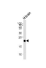 CPLX3 Antibody in Western Blot (WB)