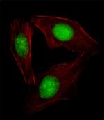 SREBP2 Antibody in Immunocytochemistry (ICC/IF)