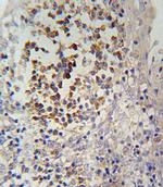 IL12RB2 Antibody in Immunohistochemistry (Paraffin) (IHC (P))