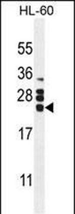 GM-CSF Antibody in Western Blot (WB)