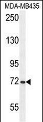 ARHGAP10 Antibody in Western Blot (WB)