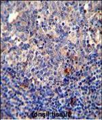 Bcl-10 Antibody in Immunohistochemistry (Paraffin) (IHC (P))