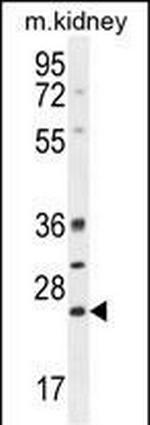 Bcl-10 Antibody in Western Blot (WB)