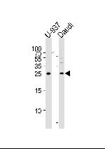 CD37 Antibody in Western Blot (WB)