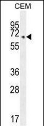 COX10 Antibody in Western Blot (WB)