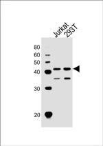 ETS1 Antibody in Western Blot (WB)