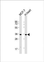 GPD1L Antibody in Western Blot (WB)