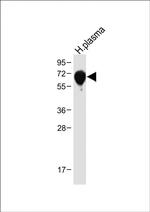 SERPINA6 Antibody in Western Blot (WB)