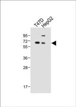 SERPINA6 Antibody in Western Blot (WB)