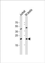 ORMDL3 Antibody in Western Blot (WB)