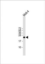 ORMDL3 Antibody in Western Blot (WB)