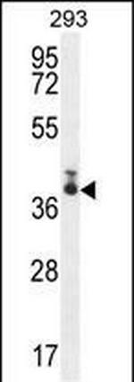 TMEM66 Antibody in Western Blot (WB)