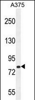 WDPCP Antibody in Western Blot (WB)