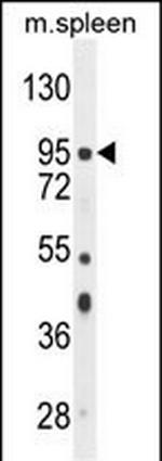 NSUN2 Antibody in Western Blot (WB)