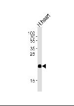 ORMDL2 Antibody in Western Blot (WB)