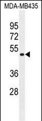 TAPT1 Antibody in Western Blot (WB)