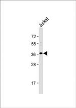 OR8B8 Antibody in Western Blot (WB)