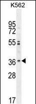 OR2M3 Antibody in Western Blot (WB)